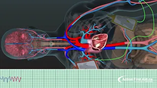AED in Action | A 3D Look Inside the Body