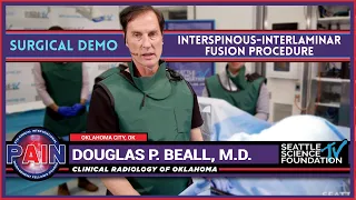 Interspinous Interlaminar Fusion Procedure  Douglas P. Beall, M.D.