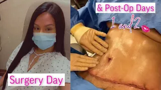 Tummy Tuck Vlog || Surgery Day & Post Op Days 1 & 2 💓