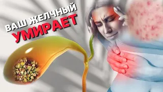 СОХРАНИ свой ЖЕЛЧНЫЙ без ВРАЧЕЙ! Причины и симптомы ЗАСТОЯ ЖЕЛЧИ