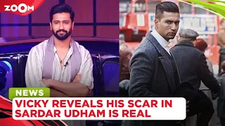 Vicky Kaushal reveals scar on his face in film Sardar Udham is real