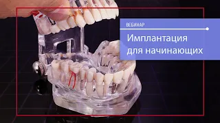 Имплантация для начинающих