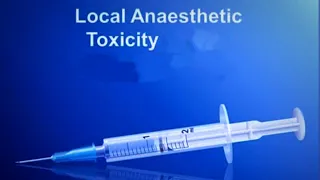 SYSTEMIC LOCAL ANAESTHETIC TOXICITY.... part 1