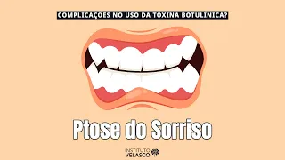 Alterações no sorriso depois do Botox! Complicações da Toxina Botulínica [Harmonização Facial]