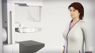 Mammogram for breast cancer - What to expect