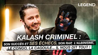 KALASH CRIMINEL : SON SUCCÈS ET SES ÉCHECS, SON RAP,  L'ALBINISME, LE CONGO... IL NOUS DIT TOUT !