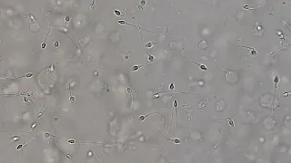 Human live sperms in semen Microscopy in 4K
