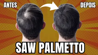 SAW PALMETTO, REMÉDIO NATURAL PARA QUEDA DE CABELO: FUNCIONA?