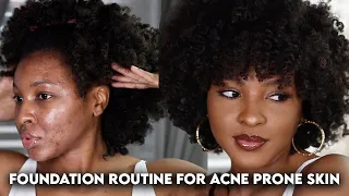 FLAWLESS FOUNDATION ROUTINE FOR ACNE PRONE/TEXTURED SKIN | KENSTHETIC