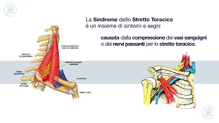 Presentazione del corso FAD "La Sindrome dello Stretto Toracico" a cura del Dott. Diego Marutti