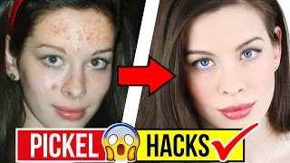 5 ANTI PICKEL HACKS & FEHLER die DU TÄGLICH bei der HAUTPFLEGE machst!! 😨