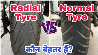 Radial Tyres Vs Normal (Bias Ply) Tyres - Which Is Better? | Advantages & Disadvantages | Hindi