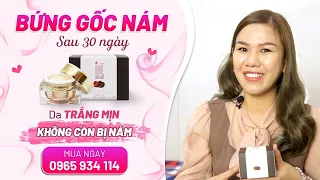 Hot mom Đỗ Hiền tự tin với làn da trắng mịn sau khi dùng White Shinno Nhật Bản