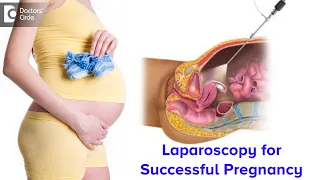 Laparoscopy in Infertility Treatment for successful pregnancy - Dr.Rashmi Yogish | Doctors' Circle