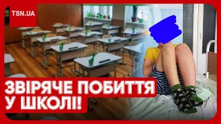 🤯⚡️ У Києві 13-річного хлопчика жорстоко побили у школі: нога збільшилась у півтора раза!