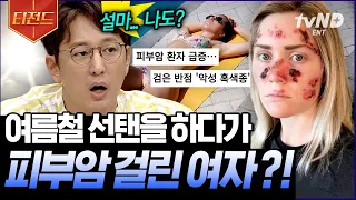 [#티전드] 선탠 매니아들 주의💥 매력적인 피부를 가지려다 지울 수 없는 상처만 남은 실화 | #프리한19