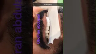 صفوة المهيدب لطب الاسنان
