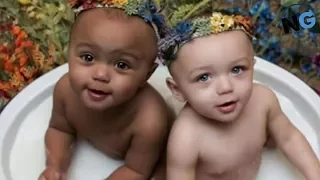 These Twins With Different Skin Colors Are ‘1 In A Million’ – Here They Are All Grown Up