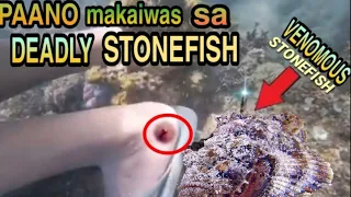 HOW to SURVIVE STONEFISH STING (tagalog version)