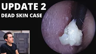 UPDATE 2 On Rapid Skin Shedding Case