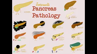 Name That Pathology: Pancreas