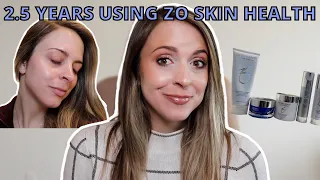 2.5 YEARS ON MEDICAL GRADE SKINCARE: My Everyday Routine| ZO Skin Health Review - Is It Worth The $?