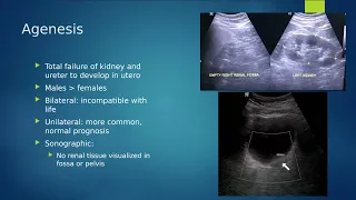 Renal Pathology