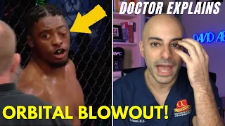 MMA EYE INJURY - ORBITAL BLOWOUT From Punches During PFL Fight! - Ringside Doctor Explains