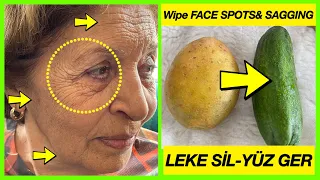 % 💯 Effective! My Aunt is 77 Years Old - WE WIPED DARK FACE SPOTS WITH POTATOES - STOP SAGGING FACE