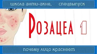 98| РОЗАЦЕА 1 | Rosacea | Лечится ли, причины и ошибки