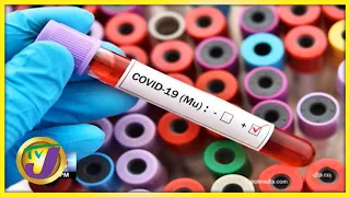 The MU Variant of the Coronavirus | TVJ News - Sept 15 2021