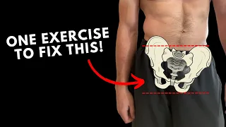 Fix Lateral Pelvic Tilt In ONE Exercise!