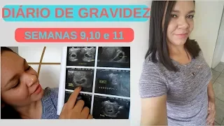 DIÁRIO DE GRAVIDEZ|9,10 E 11 SEMANAS
