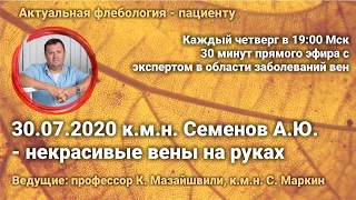 30 минут с флебологом о современных методах лечения варикоза