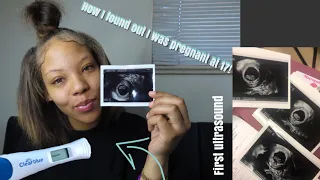 How I found out I was pregnant at 17