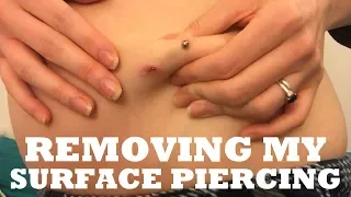 Removing My Surface Piercing | TheTarative