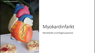 Herzinfarkt & Angina pectoris einfach erklärt NSTEMI STEMI akutes Koronarsyndrom Risikofaktoren