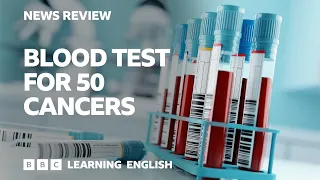 Blood test for 50 cancers: BBC News Review