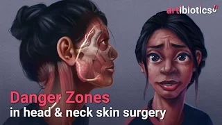 Danger zones in head & neck skin surgery