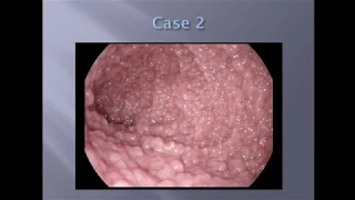 #GIpath - Adventures in the Small Intestine