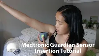 MEDTRONIC GUARDIAN SENSOR INSERTION TUTORIAL