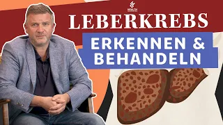 Leberkrebs erkennen und behandeln: Alles Wichtige zum Thema! | Health Celerates