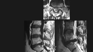 Imaging of Low Back Pain Dr Mamdouh Mahfouz