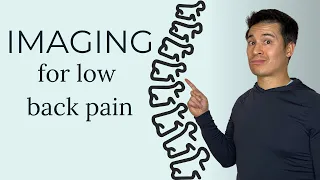 When imaging (X-ray & MRI) is needed for low back pain