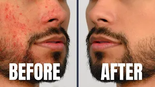 7 Skin Care Tricks Attractive/Handsome Guys Do DAILY