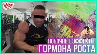 Гормон роста курс и побочные эффекты ( до после )