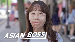 Meet The Korean Girl Who Survived 95% Burns | EVERYDAY BOSSES #12