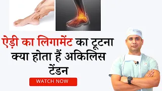 अकिलिस टेंडन( ऐड़ी का लिगामेंट ) टूटना | क्या होता है? Achilles tendon rupture/ tendoachiliis tear