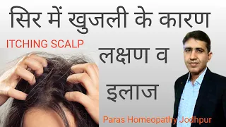 सिर में खुजली के कारण ,लक्षण और परमानेंट होम्योपैथिक इलाज | Itching Scalp Homeopathic Medicine Hindi