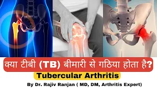 क्या टीबी बीमारी से गठिया हो सकता है ? | Arthritis by Tuberculosis